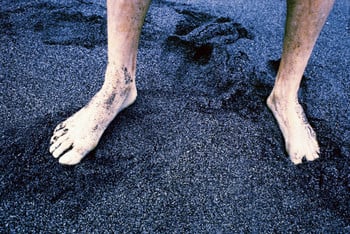 God heals the beautiful feet of an evangelist