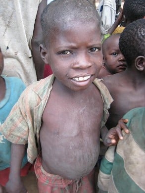Why I Don't Believe in Aid
